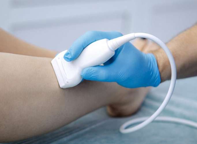 Vascular Screening & Ongoing Follow-up